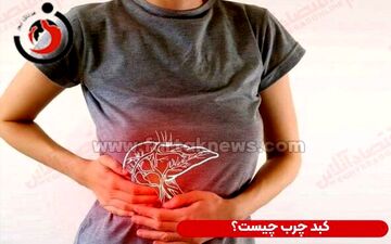 
10 غذای برتر شستشو دهنده کبد را می شناسید ؟
