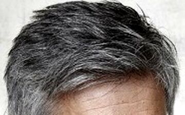 هر آنچه موهای سفید از وضعیت سلامتی‌ ما می گویند