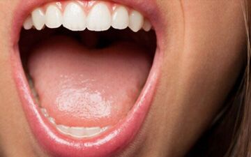 رنگ زبان از چه بیماری خبر می دهد؟

