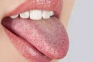 رنگ زبان چه بیماری هایی را نشان می دهد؟