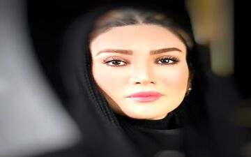 بازیگران زن ایرانی رکوددار عمل های زیبایی/ از الناز حبیبی تا نیوشا ضیغمی
