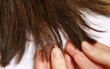 از مشکلی به نام موخوره بیشتر بدانیم
