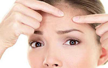  راهکارهای ساده خانگی برای از بین بردن جوش