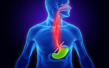 رفلاکس معده اذیتت میکنه؟ درمانش رو نمی دونی؟ بیا تا همه چی رو بهت بگم!