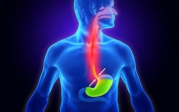 رفلاکس معده اذیتت میکنه؟ درمانش رو نمی دونی؟ بیا تا همه چی رو بهت بگم!