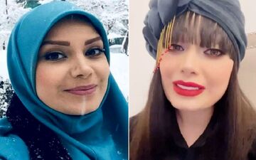 چهره بدون روتوش و فیلتر صبا راد همه را شوکه کرد + عکس باورنکردنی