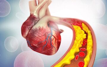 شیر باعث چربی خون می شود؟