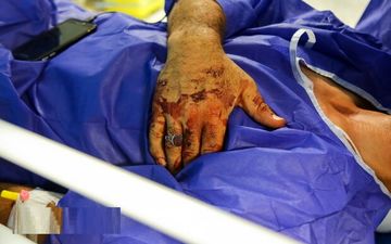 انفجار کامیون حامل سوخت در فیروزکوه/۲ تن کشته و ۵ نفر مصدوم شدند
