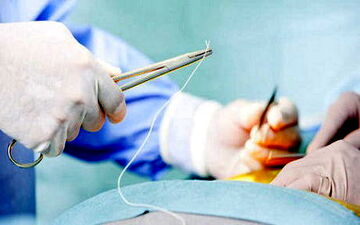 مهم‌ترین علل مرگ زنان ایرانی/تشریح بسته خدمتی وزارت بهداشت