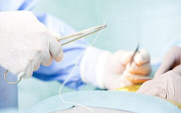 مهم‌ترین علل مرگ زنان ایرانی/تشریح بسته خدمتی وزارت بهداشت