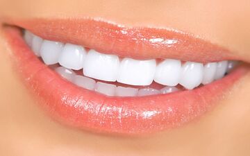 کامپوزیت برای دندان های کج، نامرتب و روی هم رفته امکانپذیر است؟