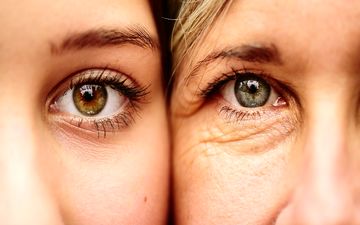 پوست صورت از چه سنی و چرا پیر میشود؟
