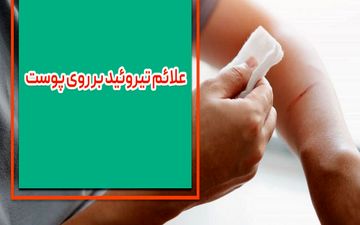 علائم تیروئید بر روی پوست چیست؟