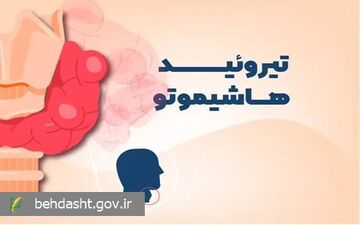 علایم یک بیماری خودایمنی شایع بر اثر اختلالات تیروئیدی را بشناسید