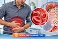 پورفیری حاد متناوب چیست؟ بیماری نادری که با درد شدید شکم و علائم عصبی ظاهر می‌شود