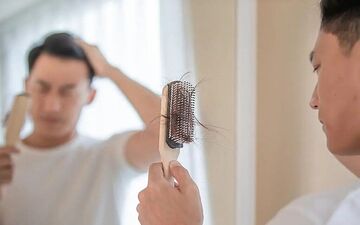 ریزش مو در نوجوانان؛ مقصر تغذیه است یا استرس و ژنتیک؟