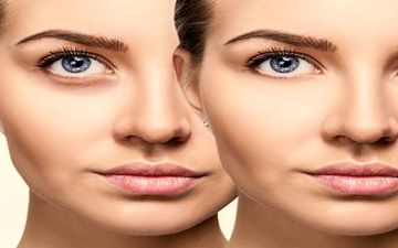 شایع ترین علل نابینایی
