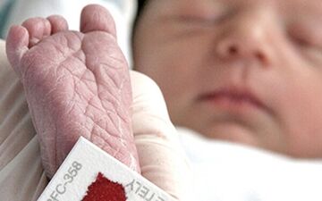 کم کاری تیروئید نوزادان را عقب مانده می کند