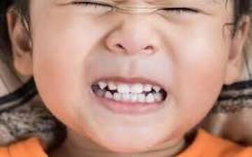 دندان‌قروچه چرا اتفاق می افتد؟