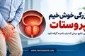 بزرگی خوش‌خیم پروستات؛ بیماری شایع مردان که نباید نادیده گرفته شود