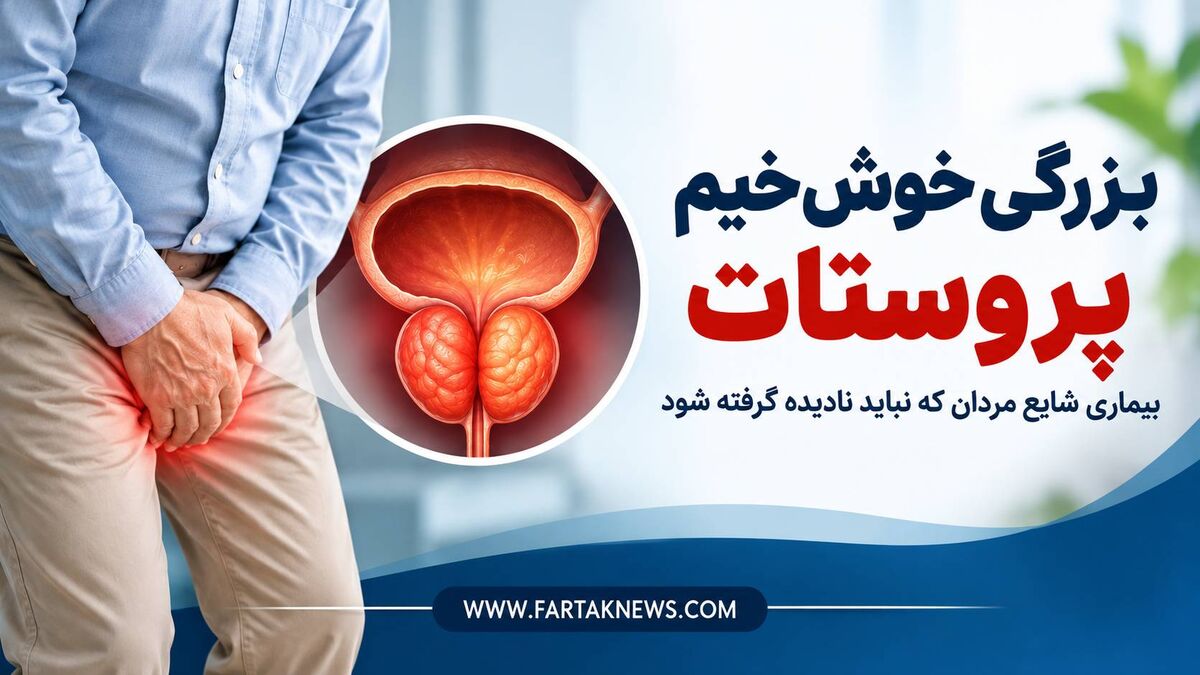 بزرگی خوش‌خیم پروستات؛ بیماری شایع مردان که نباید نادیده گرفته شود